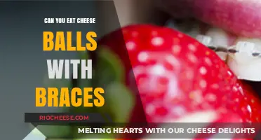 Cheesy Dilemma: Braces and the Quest for the Perfect Snack