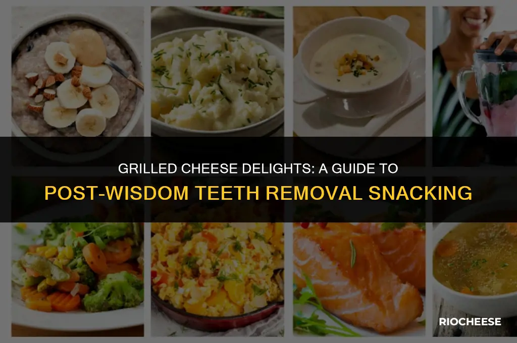 can you eat grilled cheese after wisdom teeth removal