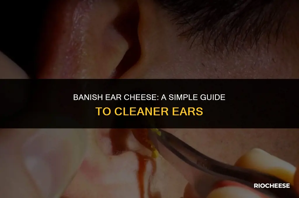 how to get rid of ear cheese