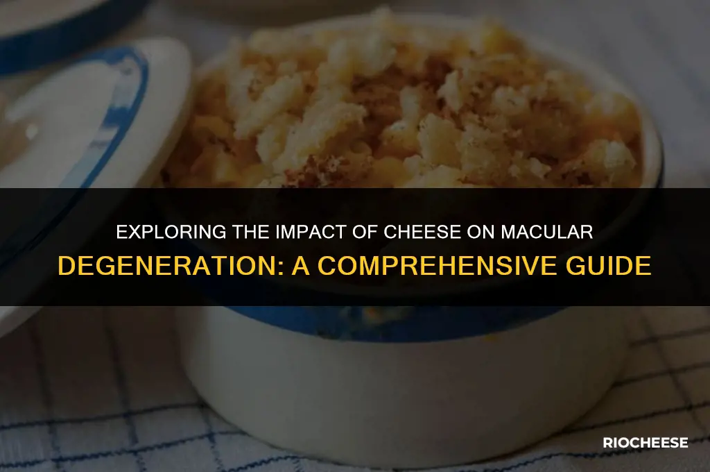 is cheese bad for macular degeneration