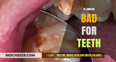 The Impact of Cheese on Dental Health: Facts and Myths