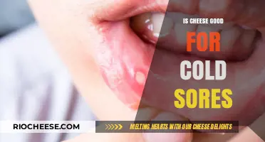 Dairy Dilemma: Can Cheese Aggravate or Soothe Cold Sores?