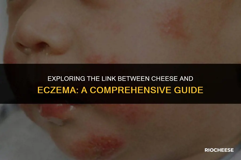 is cheese good for eczema
