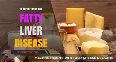 Exploring the Relationship Between Cheese Consumption and Fatty Liver Disease