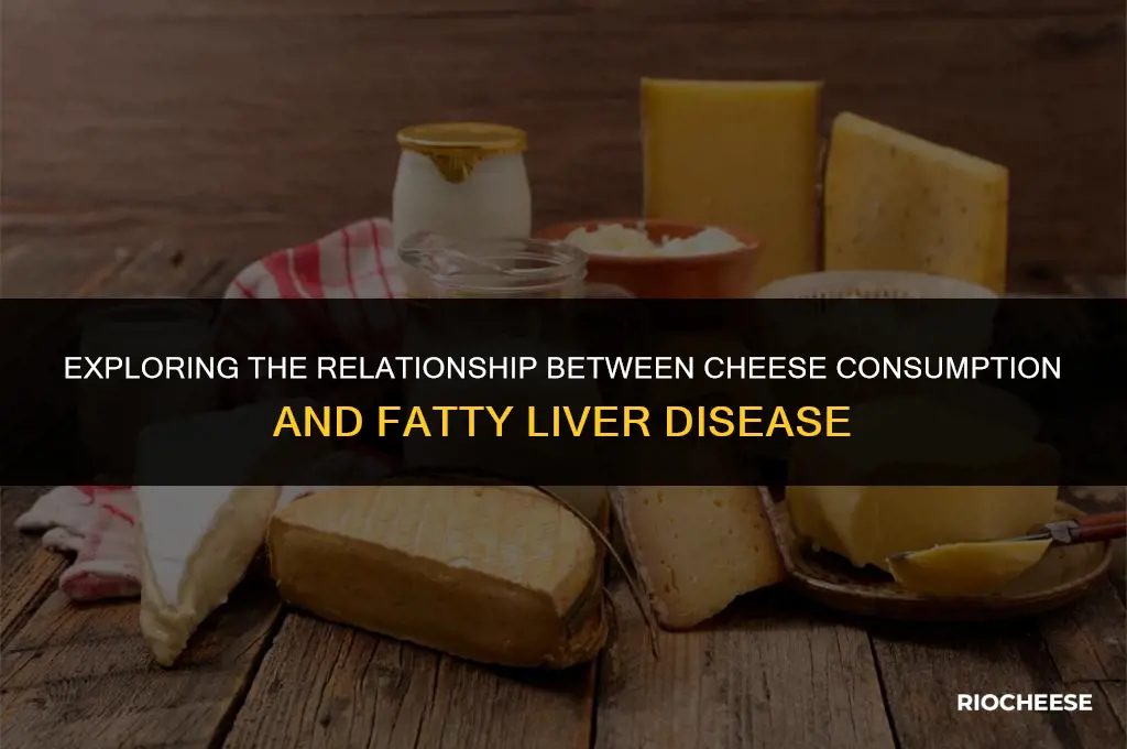 is cheese good for fatty liver disease