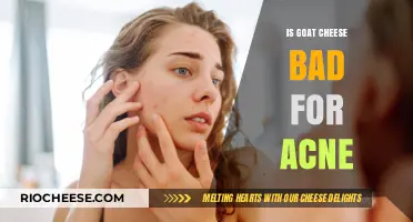 The Surprising Truth About Goat Cheese and Acne: A Dairy Dilemma