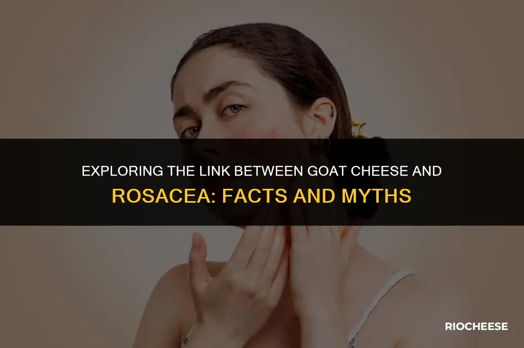 is goat cheese bad for rosacea